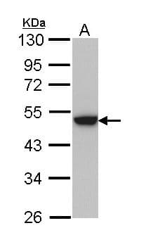 Polyclonal Rabbit anti-Human KRT31 / Keratin 31 / KRTHA1 Antibody (aa1-261, WB)