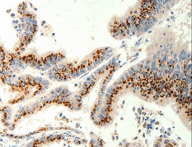 TRPC6 Antibody