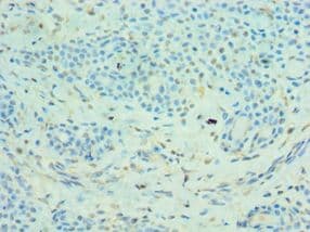 Polyclonal Rabbit anti-Human MMP14 Antibody (aa260-540, IHC)
