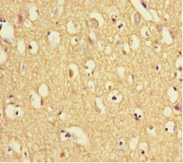 TXNDC9 Antibody