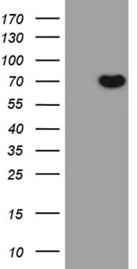 PEA3 / ETV4 Antibody (aa1-276, clone OTI5C11)