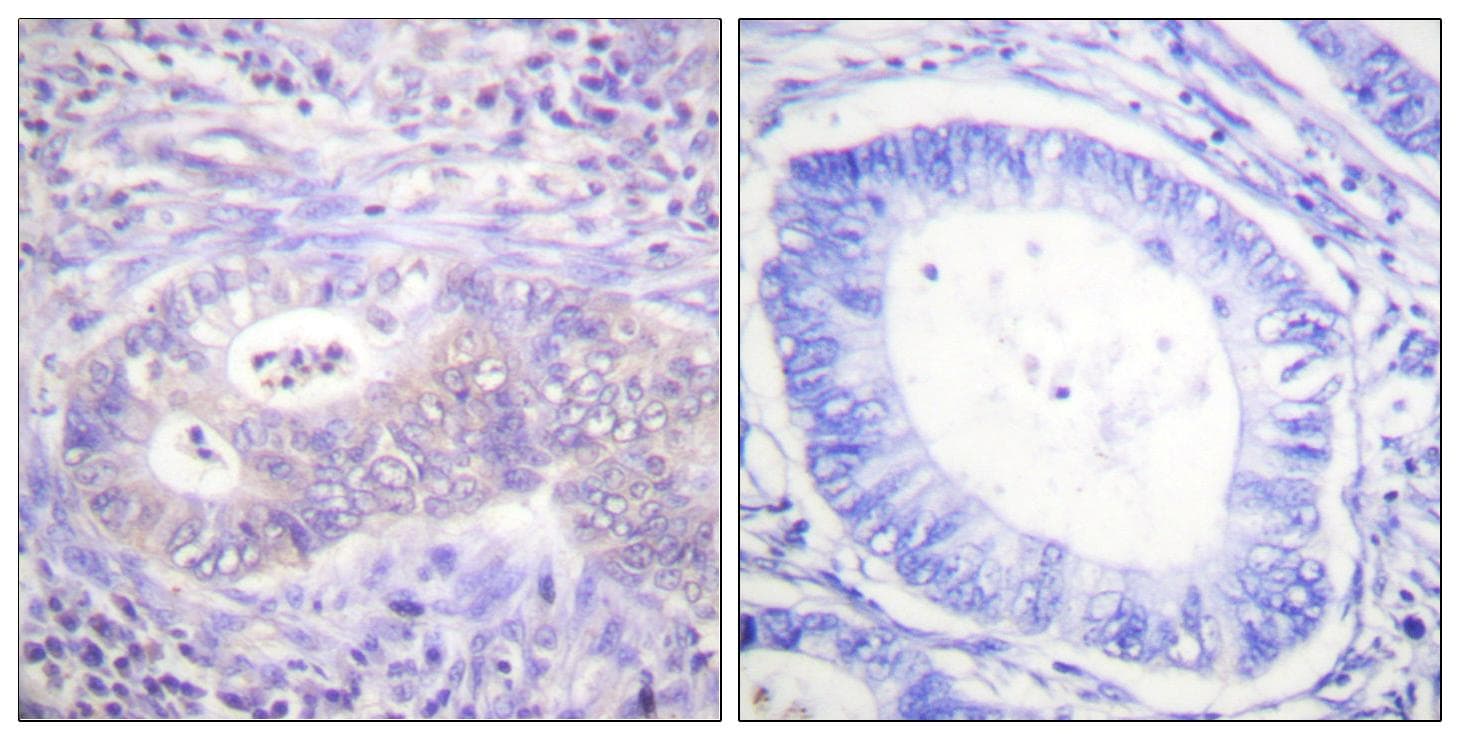 PFKFB2 Antibody (phospho-Ser483)