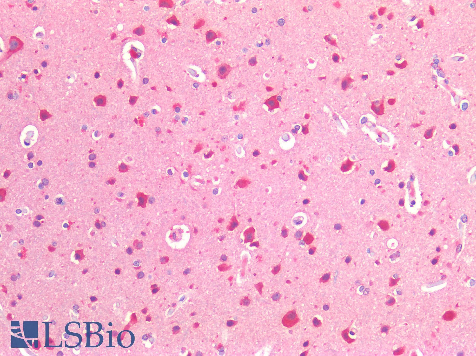 IHC-plus™ IGF1R / IGF1 Receptor Antibody