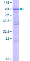 Human TGFBR2 Protein (Recombinant GST)