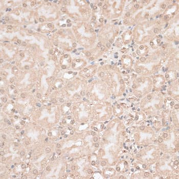 Polyclonal Rabbit anti-Human GPKOW Antibody (IHC, WB)