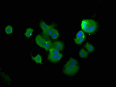 Polyclonal Rabbit anti-Human TCHP Antibody (IHC)