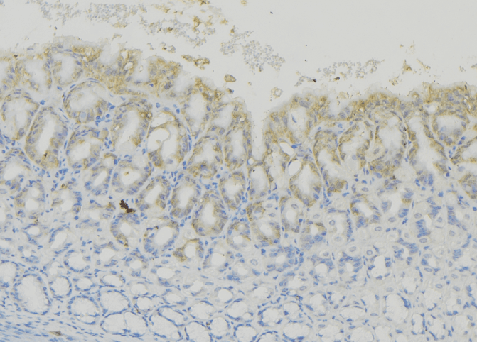 CD74 / CLIP Antibody