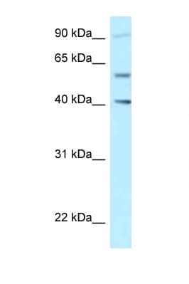 SHCBP1L / C1orf14 Antibody (aa525-574)