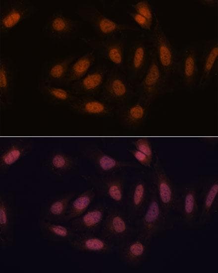 SNIP1 Antibody