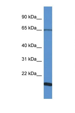 Polyclonal Rabbit anti-Human CHRNA6 Antibody (N-Terminus, WB)