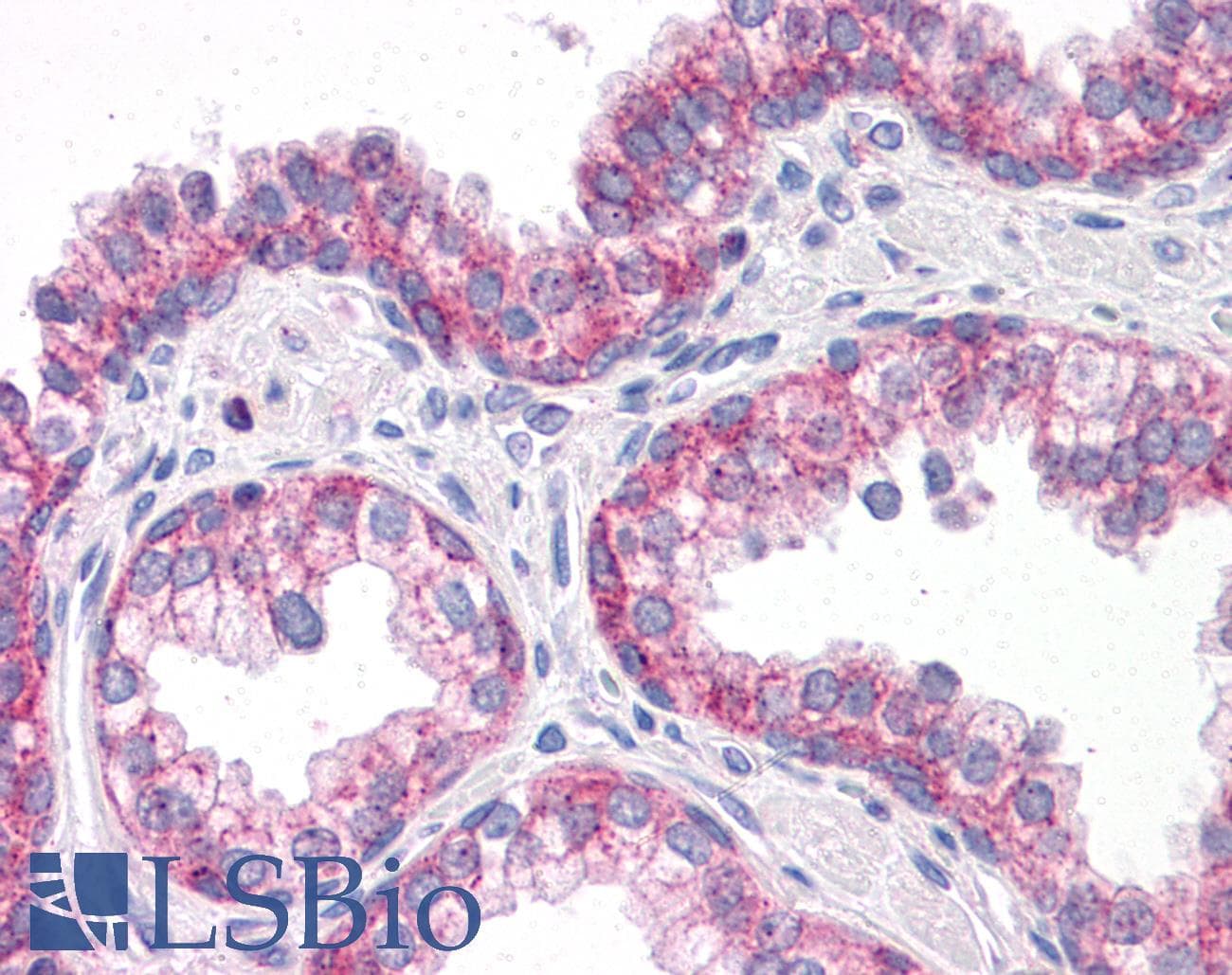 IHC-plus™ Polyclonal Rabbit anti-Human GPR32 Antibody (IHC, WB)