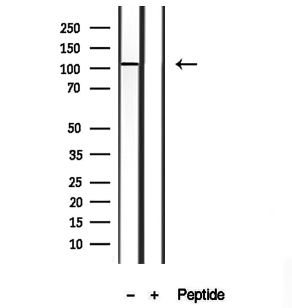 TMEM67 Antibody