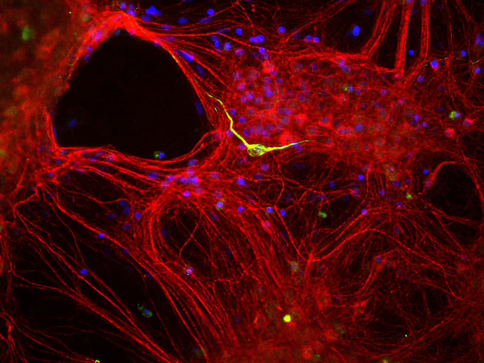 IHC-plus™ INA / Alpha Internexin Antibody