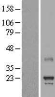 MED8 Protein (Over-Expression Lysate Myc-DDK (Flag))