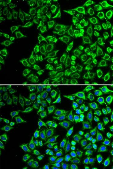 LIPC / Hepatic Lipase Antibody