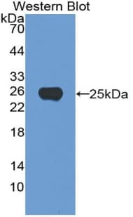 NOG / Noggin Antibody (aa28-232)