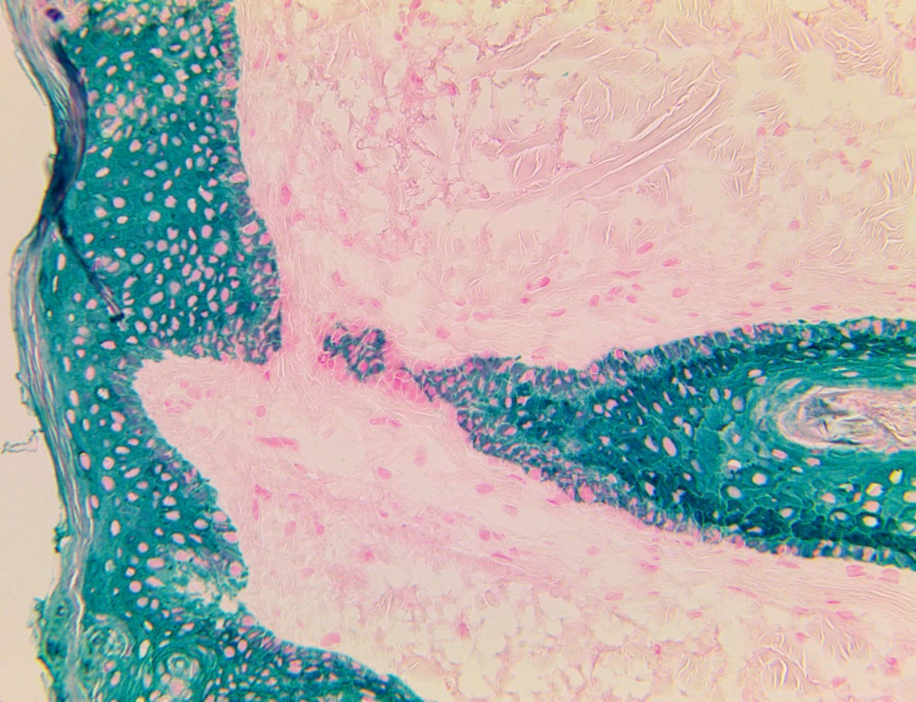 Cytokeratin 5+6 Antibody (clone D5/16B4, Ready-to-Use)
