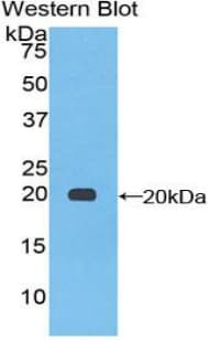 COL3A1 / Collagen III Antibody (aa434-643)