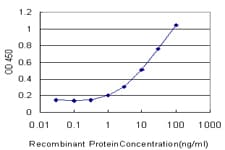 Monoclonal Mouse anti-Human ROBO2 Antibody (clone 4G5, WB)
