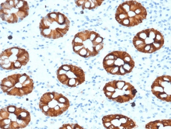 KRT20 / CK20 / Cytokeratin 20 Antibody (clone KRT20/1993, Azide-free, BSA-free)