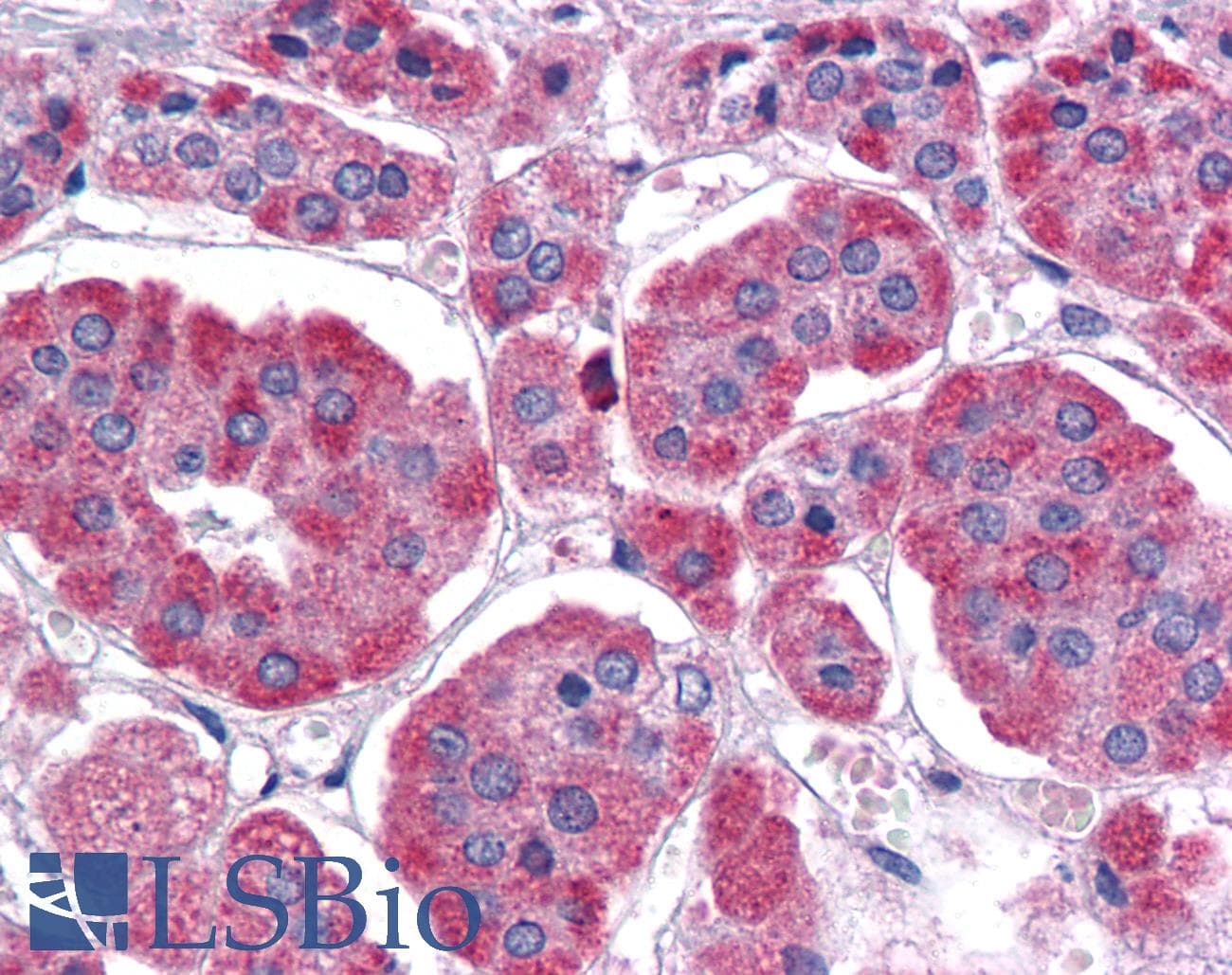 IHC-plus™ DAP-5 / EIF4G2 Antibody