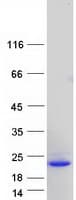 Human FGF1 / Acidic FGF Protein (Recombinant Myc-DDK (Flag))