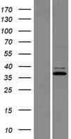 CG6 / C9orf4 Protein (Over-Expression Lysate Myc-DDK (Flag))