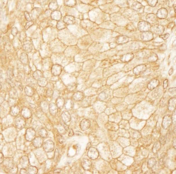 ARHGEF11 Antibody (aa1472-1522)
