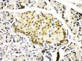 Polyclonal Rabbit anti-Human PAX6 Antibody (IHC, WB)