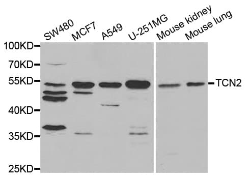 Polyclonal Rabbit anti-Human TCN2 Antibody (IHC, WB)
