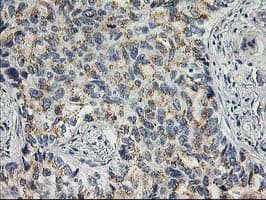 SOCS3 Antibody (clone OTI5D4)