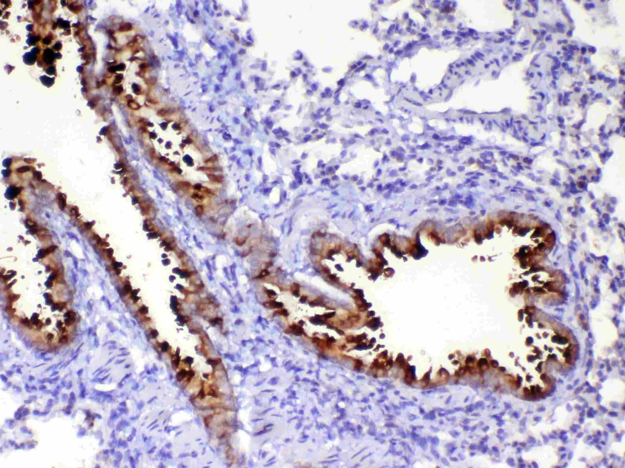 Polyclonal Rabbit anti-Rat WFDC2 / HE4 Antibody (IHC, WB)