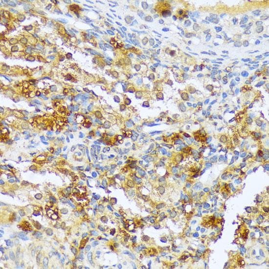 Polyclonal Rabbit anti-Human A1CF / ACF Antibody (IHC)