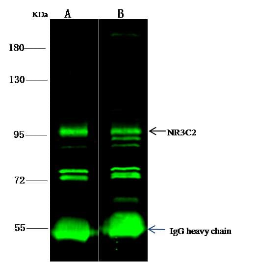 Polyclonal Rabbit anti-Human Mineralocorticoid Receptor Antibody (Preservative Free, IF, WB)