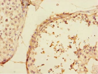 Polyclonal Rabbit anti-Human UBE2Z / USE1 Antibody (IHC, WB)
