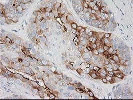 BAIAP2 / IRSP53 Antibody (clone OTI 1D9)