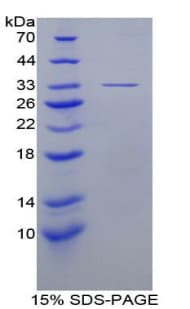 Human CTSK / Cathepsin K Protein (Recombinant His-T7)