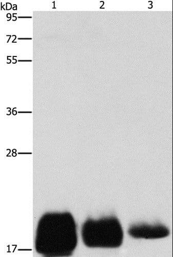 Polyclonal Rabbit anti-Human CD59 Antibody (IHC, WB)