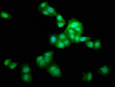 Polyclonal Rabbit anti-Human LZTS1 Antibody (IHC, IF)