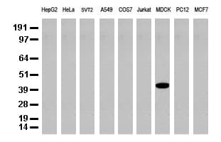 Monoclonal Mouse anti-Human KRT19 / CK19 / Cytokeratin 19 Antibody (clone UMAB3, aa240-390, IHC, IF, WB)