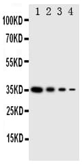 EIF2AK2 / PKR Antibody (aa2-18)