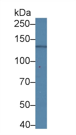 Procollagen I N-Terminal Propeptide Antibody