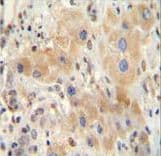 NR0B2 Antibody (aa56-83)