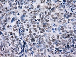 Monoclonal Mouse anti-Human L1CAM Antibody (clone OTI4F4, IHC, IF, WB)