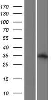 ALS2CL Protein (Over-Expression Lysate Myc-DDK (Flag))
