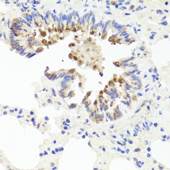 Polyclonal Rabbit anti-Human AMBRA1 Antibody (IHC, WB)