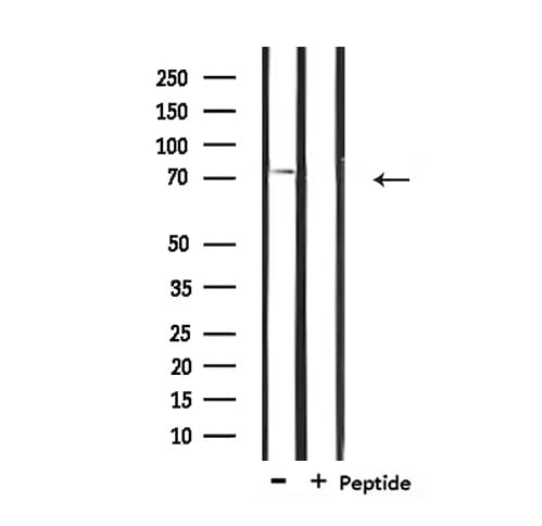 Polyclonal Rabbit anti-Human IL2RB / CD122 Antibody (IHC, IF, WB)