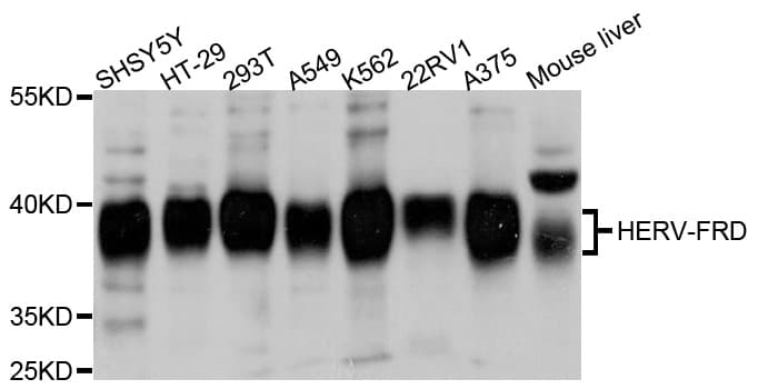 Polyclonal Rabbit anti-Human ERVFRD-1 / HERV-FRD Antibody (WB)