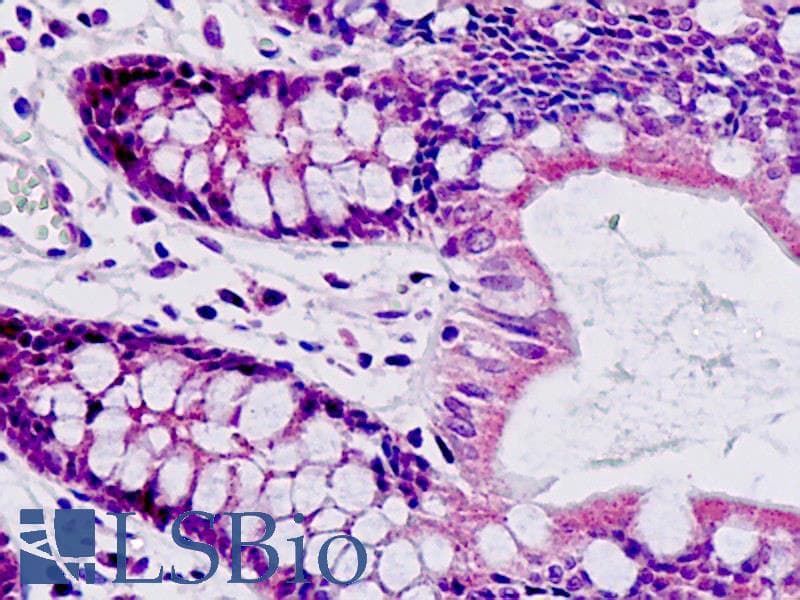 IHC-plus™ SAR1A / SAR1 Antibody (aa122-149)