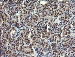 Monoclonal Mouse anti-Human LYZ / Lysozyme Antibody (clone OTI1C9, IHC, WB)